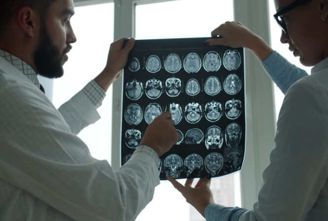 Two doctors examining a brain mri scan together.