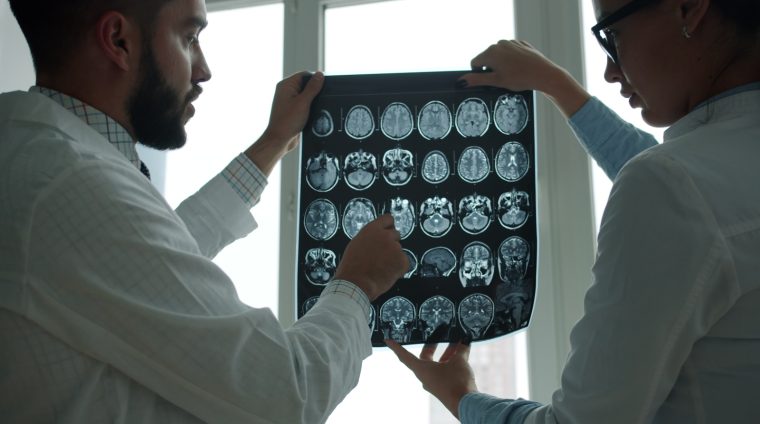 Two doctors examining a brain mri scan together.